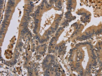 KCNA7 Antibody