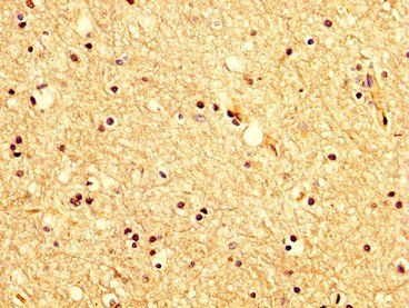 KCNAB1 Antibody