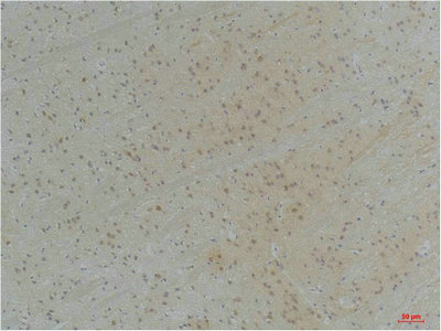 KCNAB1 Antibody