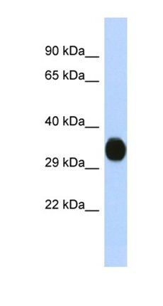 KCNAB2 antibody