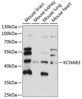 KCNAB3 antibody