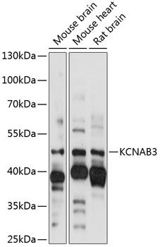KCNAB3 antibody