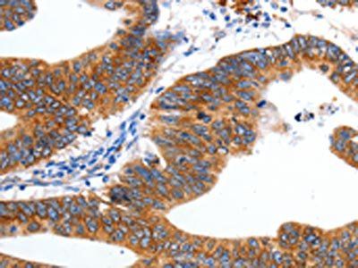 KCNC2 Antibody