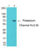 KCNC2 antibody