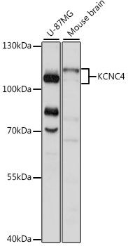 KCNC4 antibody