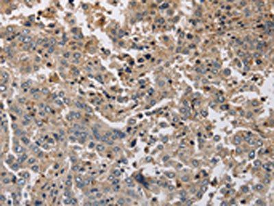 KCND1 Antibody