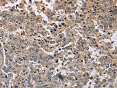 KCND1 antibody