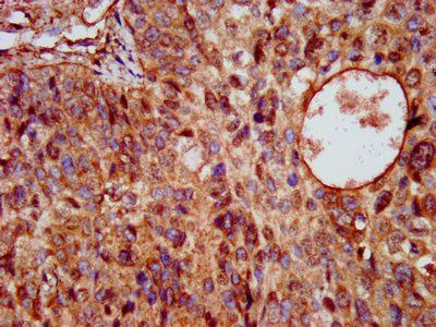KCNE3 Antibody