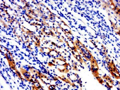 KCNE3 antibody