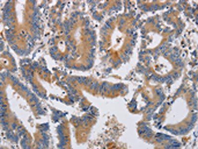 KCNG1 Antibody