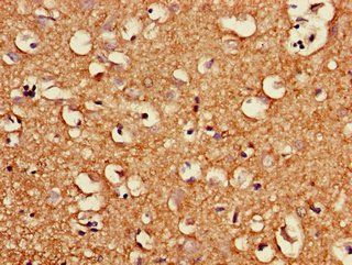KCNG4 Antibody