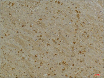 KCNH5 Antibody