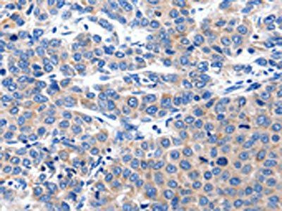 KCNH8 antibody