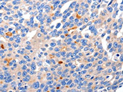 KCNH8 Antibody
