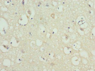 KCNIP2 Antibody