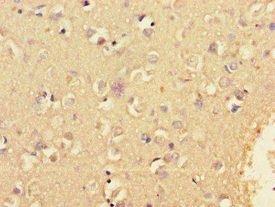 KCNIP4 Antibody