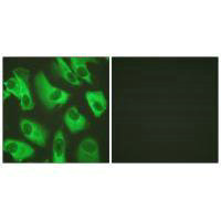 KCNJ16 (Ab-416) Antibody