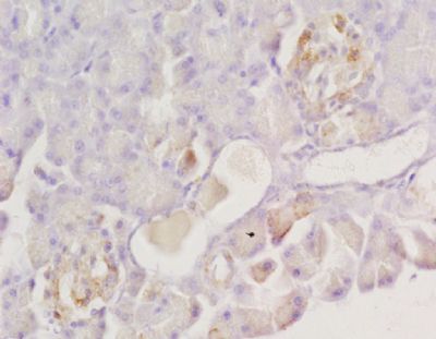 KCNJ5 Rabbit Polyclonal Antibody