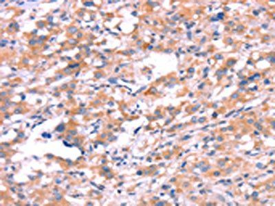 KCNJ6 antibody