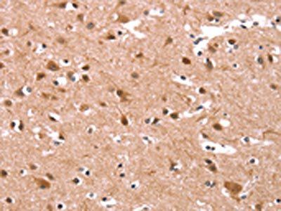 KCNJ6 Antibody
