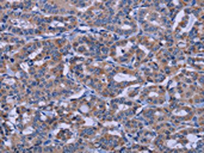 KCNJ9 antibody