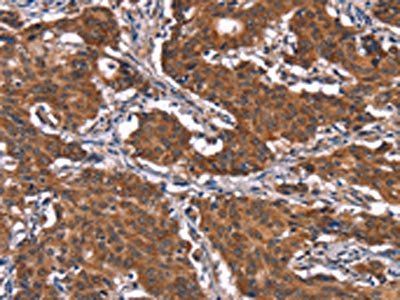 KCNJ9 Antibody