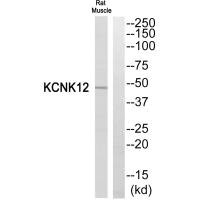 KCNK12 antibody