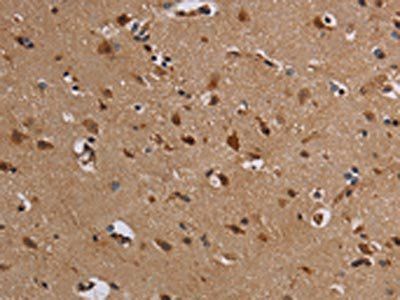 KCNK13 Antibody