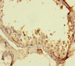 KCNK16 Antibody