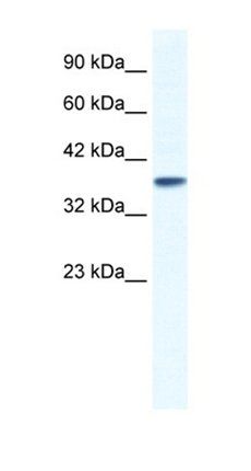 KCNK3 antibody