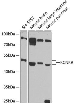 KCNK9 antibody