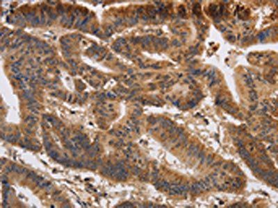 KCNK9 Antibody