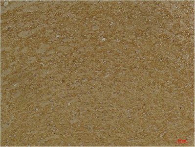 KCNK9 Antibody