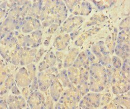KCNMA1 Antibody