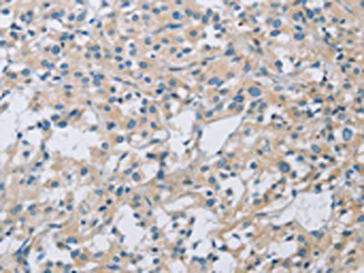 KCNMA1 Antibody
