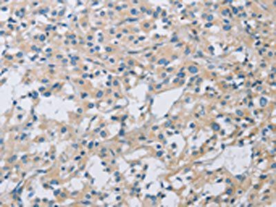 KCNMA1 antibody