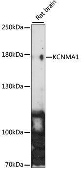 KCNMA1 antibody