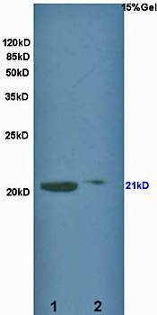 KCNMB1 antibody
