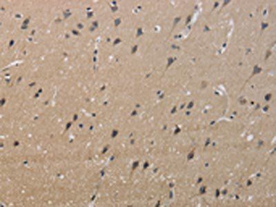 KCNMB4 Antibody