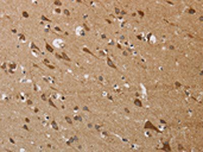 KCNMB4 Antibody
