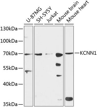 KCNN1 antibody