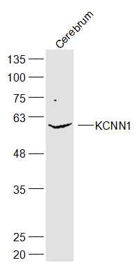 KCNN1 antibody