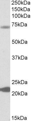 Goat anti-KCNN2 Antibody