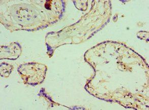 KCNN4 Antibody