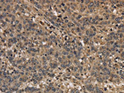 KCNN4 Antibody
