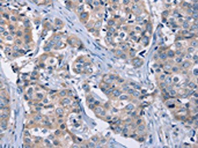 KCNQ5 Antibody
