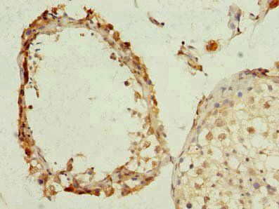 KCNRG antibody