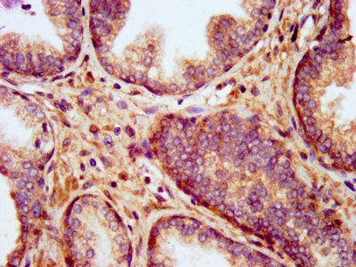 KCNT1 Antibody