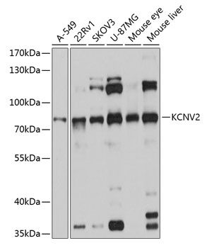 KCNV2 antibody