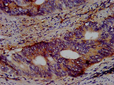 KCNV2 Antibody